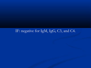 IF: negative for IgM, IgG, C3, and C4.
 