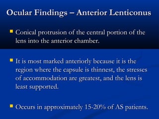 Ocular Findings – Anterior LenticonusOcular Findings – Anterior Lenticonus
 Conical protrusion of the central portion of theConical protrusion of the central portion of the
lens into the anterior chamber.lens into the anterior chamber.
 It is most marked anteriorly because it is theIt is most marked anteriorly because it is the
region where the capsule is thinnest, the stressesregion where the capsule is thinnest, the stresses
of accommodation are greatest, and the lens isof accommodation are greatest, and the lens is
least supported.least supported.
 Occurs in approximately 15-20% of AS patients.Occurs in approximately 15-20% of AS patients.
 
