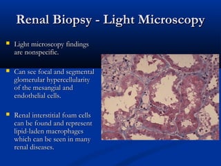 Renal Biopsy - Light MicroscopyRenal Biopsy - Light Microscopy
 Light microscopy findingsLight microscopy findings
are nonspecific.are nonspecific.
 Can see focal and segmentalCan see focal and segmental
glomerular hypercellularityglomerular hypercellularity
of the mesangial andof the mesangial and
endothelial cells.endothelial cells.
 Renal interstitial foam cellsRenal interstitial foam cells
can be found and representcan be found and represent
lipid-laden macrophageslipid-laden macrophages
which can be seen in manywhich can be seen in many
renal diseases.renal diseases.
 