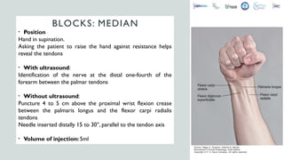 locoregional anesthesia - course -------- | PPTX