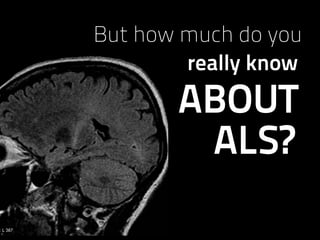 ALS?
ABOUT
really know
But how much do you
 
