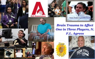 Brain Trauma to Affect 
One in Three Players, N. 
F.L. Agrees 
 