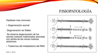 FISIOPATOLOGÍA
Hipótesis mas comunes:
• Degeneración axonal
Degeneración de Waller.
Se observa degeneración de los
axones motores mielinizados asociada
con atrofia de las raíces motoras
anteriores.
• Trastornos del metabolismo del RNA
Muñiz, C. (2015)
 