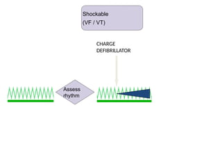 Shockable (VT)
CHARGE
DEFIBRILLATOR
Assess
rhythm
Shockable
(VF / VT)
 