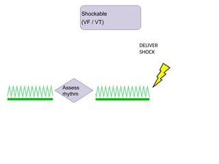 Shockable (VF / VT)
DELIVER
SHOCK
Assess
rhythm
Shockable
(VF / VT)
 
