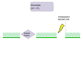 Shockable (VF / VT)
IMMEDIATELY
RESTART CPR
Assess
rhythm
Shockable
(VF / VT)
 