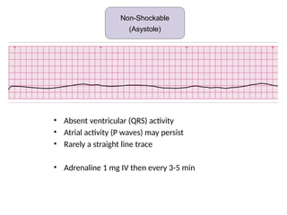 • Absent ventricular (QRS) activity
• Atrial activity (P waves) may persist
• Rarely a straight line trace
• Adrenaline 1 mg IV then every 3-5 min
Non-shockable (Asystole)
Non-Shockable
(Asystole)
 