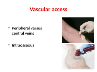 Vascular access
• Peripheral versus
central veins
• Intraosseous
 