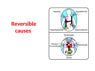 Reversible
causes
 