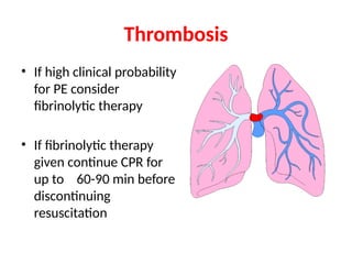 Thrombosis
• If high clinical probability
for PE consider
fibrinolytic therapy
• If fibrinolytic therapy
given continue CPR for
up to 60-90 min before
discontinuing
resuscitation
 