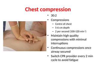Chest compression
• 30:2
• Compressions
– Centre of chest
– 5-6 cm depth
– 2 per second (100-120 min-1
)
• Maintain high quality
compressions with minimal
interruptions
• Continuous compressions once
airway secured
• Switch CPR provider every 2 min
cycle to avoid fatigue
 