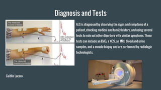 Diagnosis and Tests
ALS is diagnosed by observing the signs and symptoms of a
patient, checking medical and family history, and using several
tests to rule out other disorders with similar symptoms. These
tests can include an EMG, a NCS, an MRI, blood and urine
samples, and a muscle biopsy and are performed by radiologic
technologists.
Caitlin Lucero
 
