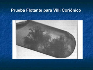Prueba Flotante para Villi Coriónico
 