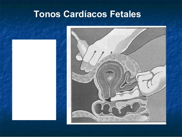 La osteocondrosis sheynogo del departamento de la columna vertebral tservikalgiya
