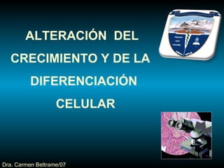 ALTERACIÓN  DEL  CRECIMIENTO Y DE LA  DIFERENCIACIÓN CELULAR Dra. Carmen Beltrame/07 