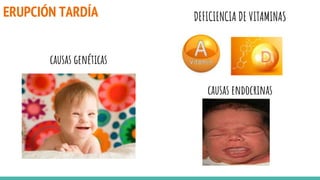 ERUPCIÓN TARDÍA
causas endocrinas
DEFICIENCIA DE VITAMINAS
causas genéticas
 