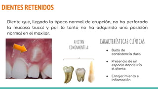 DIENTES RETENIDOS
Diente que, llegada la época normal de erupción, no ha perforado
la mucosa bucal y por lo tanto no ha adquirido una posición
normal en el maxilar.
AFECTAN
COMÚNMENTE A:
CARACTERÍSTICAS CLÍNICAS
● Bulto de
consistencia dura.
● Presencia de un
espacio donde iría
el diente.
● Enrojecimiento e
inflamación
 