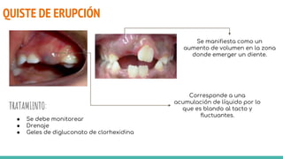 QUISTE DE ERUPCIÓN
TRATAMIENTO:
Se manifiesta como un
aumento de volumen en la zona
donde emerger un diente.
● Se debe monitorear
● Drenaje
● Geles de digluconato de clorhexidina
Corresponde a una
acumulación de líquido por lo
que es blando al tacto y
fluctuantes.
 
