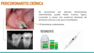PERICORONARITIS CRÓNICA
Se caracteriza por dolores retromolares
intermitentes, puede haber trismus ligero,
cursando a veces con ausencia absoluta de
síntomas clínicos o ser poco manifiestos.
Eritematosa y edematosa
tratamiento:
 