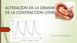 ALTERACION DE LA DINAMICA
DE LA CONTRACCION UTERINA
Dr. Jam Paul Córdoba Mejía R1
 