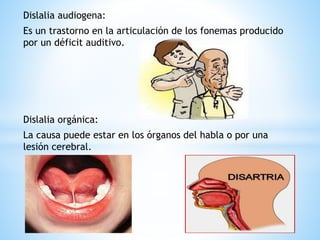 Dislalia audiogena:
Es un trastorno en la articulación de los fonemas producido
por un déficit auditivo.
Dislalia orgánica...