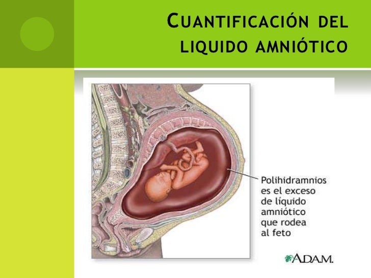 Alteracion en los volumenes de liquido amniotico