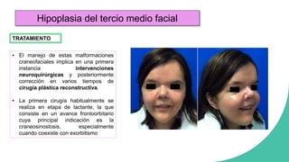 cirugia II Alteraciones congenitas de cabeza y cuello | PPTX