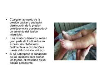 • Cualquier aumento de la
presión capilar o cualquier
disminución de la presión
coloidosmotica puede producir
un aumento del liquido
intersticial.
• Los linfáticos tisulares retiran
gran parte de los líquidos en
exceso devolviéndolos
finalmente a la circulación a
través del conducto toráxico.
• Si se Sobrepasa la capacidad
de los linfáticos para drenar
los tejidos, el resultado es un
edema persistente.
 