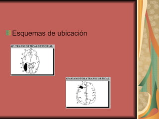 Esquemas de ubicación                                                                                                                             