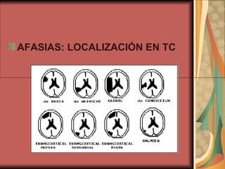 AFASIAS: LOCALIZACIÓN EN TC                                                                                   