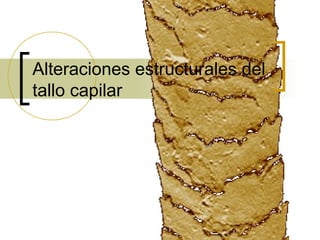 Alteraciones estructurales del
tallo capilar
 