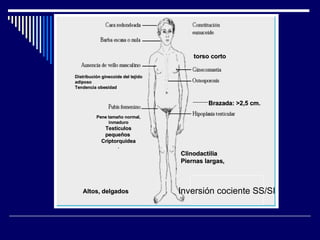 Inversión cociente SS/SI Altos, delgados Brazada: >2,5 cm. torso corto Clinodactilia Piernas largas, Distribución ginecoide del tejido adiposo  Tendencia obesidad Pene tamaño normal, inmaduro Testículos pequeños  Criptorquidea . 