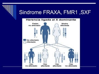 Sindrome FRAXA, FMR1 ,SXF 