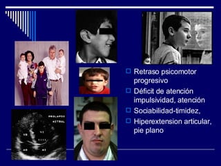 Retraso psicomotor progresivo Déficit de atención impulsividad, atención Sociabilidad-timidez, Hiperextension articular, pie plano 