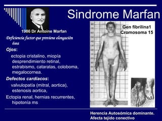 Sindrome Marfan Deficiencia factor que previene elongación ósea Ojos :  ectopia cristalino, miopía desprendimiento retinal, estrabismo, cataratas, coloboma, megalocornea. Defectos cardiacos : valvulopatía (mitral, aortica), estenosis aortica,  Ectopia renal, hernias recurrentes, hipotonía ms Gen fibrilina1 Cromosoma 15 1986 Dr Antoine Marfan Herencia Autosómica dominante.  Afecta tejido conectivo 
