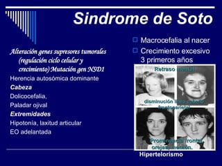 Sindrome de Soto Alteración genes supresores tumorales (regulación ciclo celular y crecimiento) Mutación gen NSD1 Herencia autosómica dominante Cabeza Dolicocefalia, Paladar ojival Extremidades Hipotonía, laxitud articular EO adelantada Macrocefalia al nacer Crecimiento excesivo 3 primeros años Hipertelorismo Prominencia frontal, orejas, mentón. Retraso mental disminución linea cabello frontoparietal 