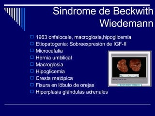 Sindrome de Beckwith Wiedemann 1963 onfalocele, macroglosia,hipoglicemia Etiopatogenia: Sobreexpresión de IGF-II Microcefalia Hernia umbilical Macroglosia Hipoglicemia Cresta metópica Fisura en lóbulo de orejas Hiperplasia glándulas adrenales 