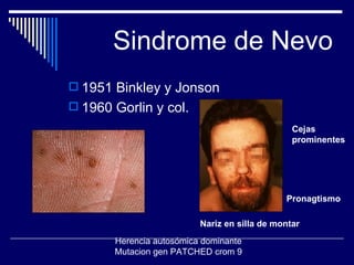 Sindrome de Nevo 1951 Binkley y Jonson 1960 Gorlin y col. Nariz en silla de montar Cejas prominentes Pronagtismo Herencia autosómica dominante Mutacion gen PATCHED crom 9 
