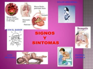 DOLOR ABDOMINAL




Cl EN EL SUDOR




  ILEO                        DIARREA
MECONIAL                      CRONICA
 