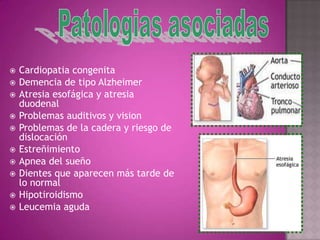    Cardiopatia congenita
   Demencia de tipo Alzheimer
   Atresia esofágica y atresia
    duodenal
   Problemas auditivos y vision
   Problemas de la cadera y riesgo de
    dislocación
   Estreñimiento
   Apnea del sueño
   Dientes que aparecen más tarde de
    lo normal
   Hipotiroidismo
   Leucemia aguda
 