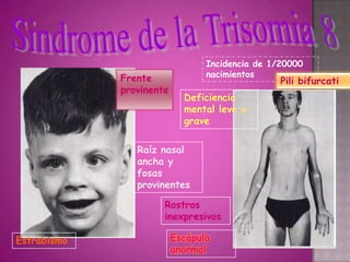 Incidencia de 1/20000
             Frente              nacimientos
                                                 Pili bifurcati
             provinente
                            Deficiencia
                            mental leve o
                            grave

                Raíz nasal
                ancha y
                fosas
                provinentes

                      Rostros
                      inexpresivos

Estrabismo                Escápula
                          anormal
 