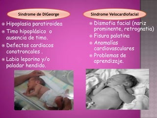 Síndrome de DiGeorge   Síndrome Velocardiofacial

 Hipoplasia paratiroidea     Dismofia facial (nariz
 Timo hipoplásico o
                               prominente, retrognatia)
  ausencia de timo.           Fisura palatina
                              Anomalías
 Defectos cardiacos
                               cardiovasculares
  conotroncales .
                              Problemas de
 Labio leporino y/o           aprendizaje.
  paladar hendido.
 