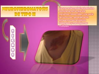 Es una enfermedad autosómica
dominante en la que los
pacientes desarrollan una serie
de tumo-res, generalmente
schwannomas acústicos
bilaterales y meningiomas
múltiples.
 