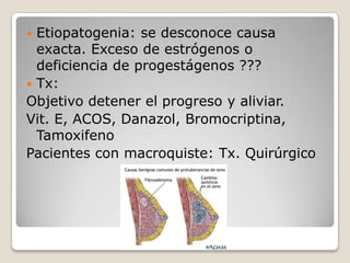  Etiopatogenia: se desconoce causa
  exacta. Exceso de estrógenos o
  deficiencia de progestágenos ???
 Tx:
Objetivo detener el progreso y aliviar.
Vit. E, ACOS, Danazol, Bromocriptina,
  Tamoxifeno
Pacientes con macroquiste: Tx. Quirúrgico
 