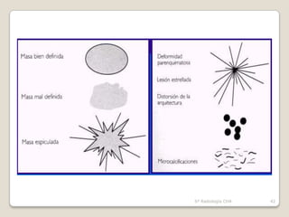 Sº Radiología CHA   42
 