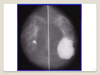 Sº Radiología CHA   44
 