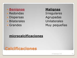    Benignas               Malignas
   Redondas               Irregulares
   Dispersas              Agrupadas
   Bilaterales            Unilaterales
   Grandes                Muy pequeñas


    microcalcificaciones



Calcificaciones
                              Sº Radiología CHA   50
 