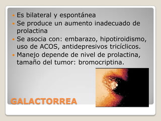  Es bilateral y espontánea
 Se produce un aumento inadecuado de
  prolactina
 Se asocia con: embarazo, hipotiroidismo,
  uso de ACOS, antidepresivos tricíclicos.
 Manejo depende de nivel de prolactina,
  tamaño del tumor: bromocriptina.




GALACTORREA
 