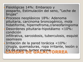  Fisiológicas 14%: Embarazo y
  posparto, Estimulación del seno, “Leche de
  brujas”
 Procesos neoplásicos 18%: Adenoma
  pituitaria, carcinoma broncogénico, mola
  hidatiforme, hipernefroma,craneofaringioma
 Desordenes pituitaria-hipotálamo <10%:
  condición
  infiltrativa, sarcoidosis, tuberculosis, esquist
  osomiasis
 Irritación de la pared torácica <10%:
  cirugía, quemaduras, ropa irritante, lesión o
  Cx de espina, tumor espina
    CAUSAS DE GALACTORREA
 