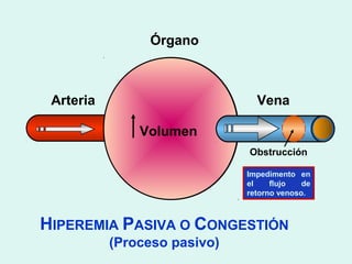 Órgano



 Arteria                        Vena

               Volumen
                              Obstrucción

                              Impedimento en
                              el    flujo   de
                              retorno venoso.



HIPEREMIA PASIVA O CONGESTIÓN
           (Proceso pasivo)
 